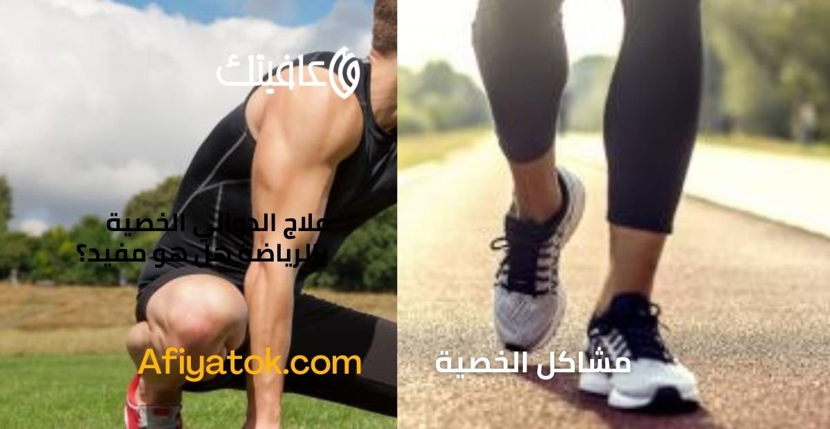 علاج الدوالي الخصية بالرياضة هل هو مفيد؟